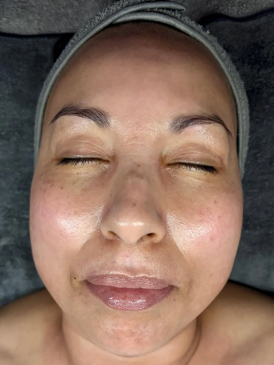 A facial treatment in progress