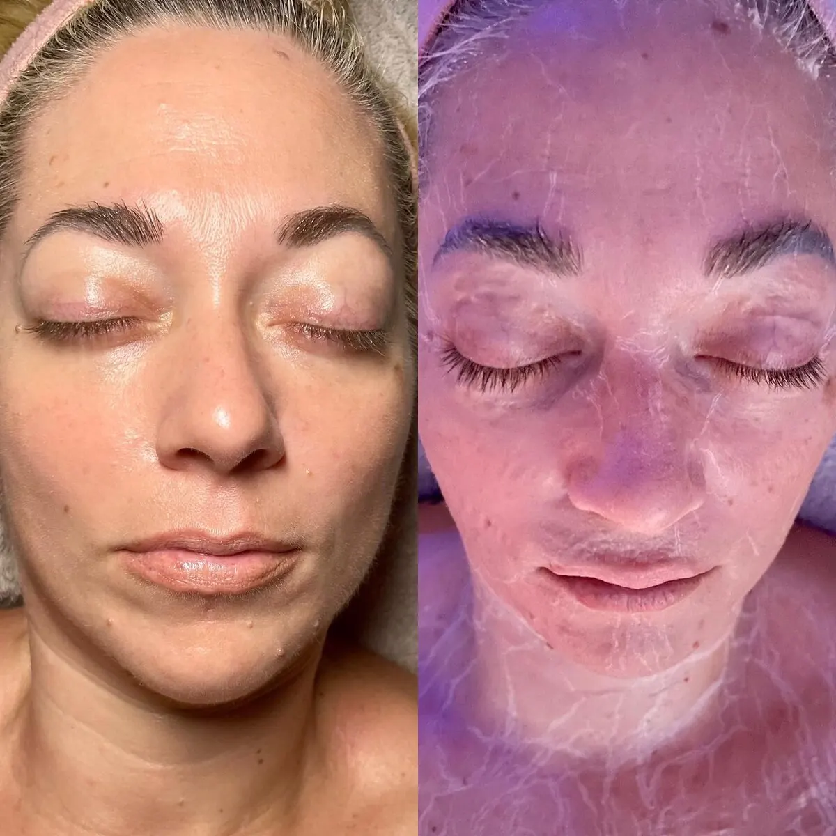 Fit and Firm Facial